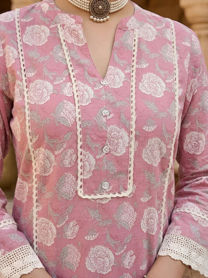 Design 1